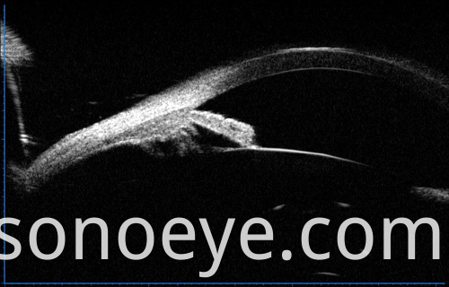 image for Ophthalmic A/B Scanner